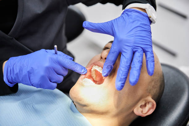 Best Emergency Gum Treatment in Darnestown, MD